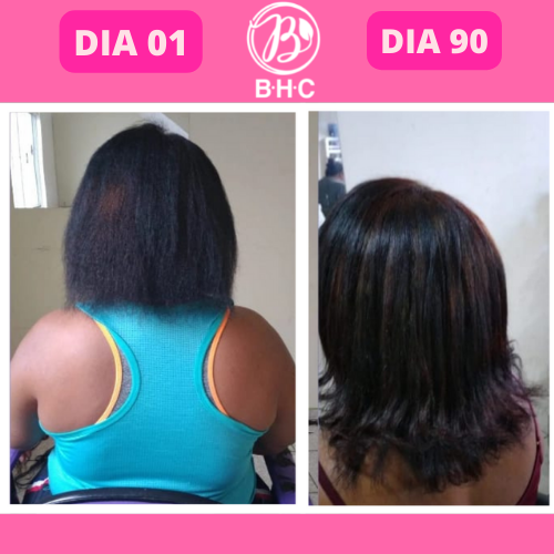 suplemento para cabelo, remedio pro cabelo crescer, bhc premium, vitamina para queda de cabelo, suplemento capilar, capsulas para cabelo, tratamento para fortalecer o cabelo, suplemento para crescimento capilar, produto para queda de cabelo, remedio para fortalecer os fios, suplemento para crescer cabelo rápido, tratamento antiqueda, capsulas para queda de cabelo, remedio natural para queda de cabelo, suplemento capilar feminino, suplemento para cabelos fracos, remedio para crescimento capilar rápido, suplemento para queda e crescimento, vitaminas para calvície, tratamento para queda de cabelo feminino