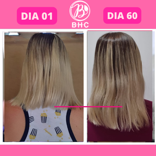 suplemento para cabelo, remedio pro cabelo crescer, bhc premium, vitamina para queda de cabelo, suplemento capilar, capsulas para cabelo, tratamento para fortalecer o cabelo, suplemento para crescimento capilar, produto para queda de cabelo, remedio para fortalecer os fios, suplemento para crescer cabelo rápido, tratamento antiqueda, capsulas para queda de cabelo, remedio natural para queda de cabelo, suplemento capilar feminino, suplemento para cabelos fracos, remedio para crescimento capilar rápido, suplemento para queda e crescimento, vitaminas para calvície, tratamento para queda de cabelo feminino