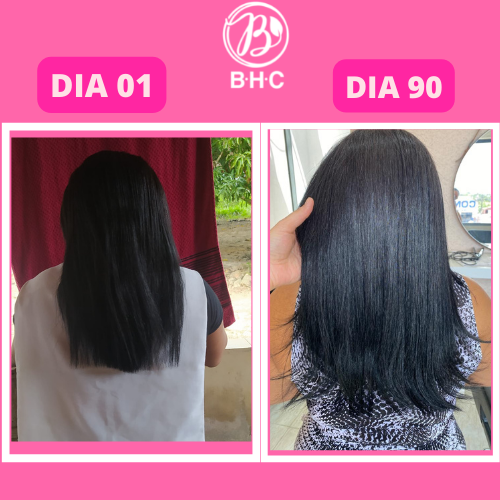 suplemento para cabelo, remedio pro cabelo crescer, bhc premium, vitamina para queda de cabelo, suplemento capilar, capsulas para cabelo, tratamento para fortalecer o cabelo, suplemento para crescimento capilar, produto para queda de cabelo, remedio para fortalecer os fios, suplemento para crescer cabelo rápido, tratamento antiqueda, capsulas para queda de cabelo, remedio natural para queda de cabelo, suplemento capilar feminino, suplemento para cabelos fracos, remedio para crescimento capilar rápido, suplemento para queda e crescimento, vitaminas para calvície, tratamento para queda de cabelo feminino